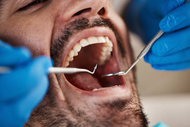 Best Emergency Broken Tooth Repair in Ruhenstroth, NV